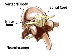 Nine Spinal Stenosis Treatment Options to Help with Pain